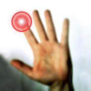  Simon Glass (2010). Нажмите, чтобы увеличить.