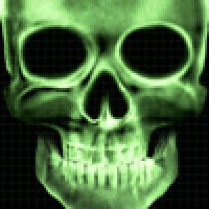  Skull X-Ray (2010). Нажмите, чтобы увеличить.