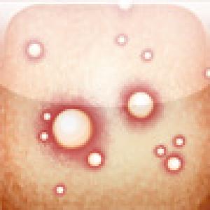  Zits & Giggles (2009). Нажмите, чтобы увеличить.