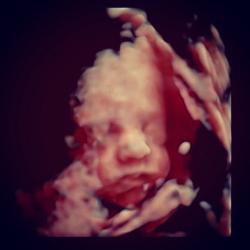 Vita. Передняя обложка. Нажмите, чтобы увеличить. Vita. Передняя обложка. Нажмите, чтобы увеличить.